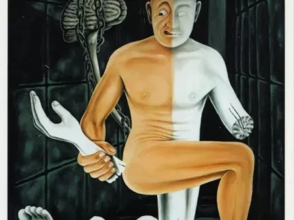 Postcard - Paralysis