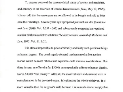 Article - Only an Auction Market for Organs Will Work